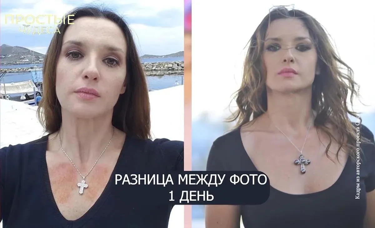 Оксана Марченко заявила о божественном исцелении от загадочных ран