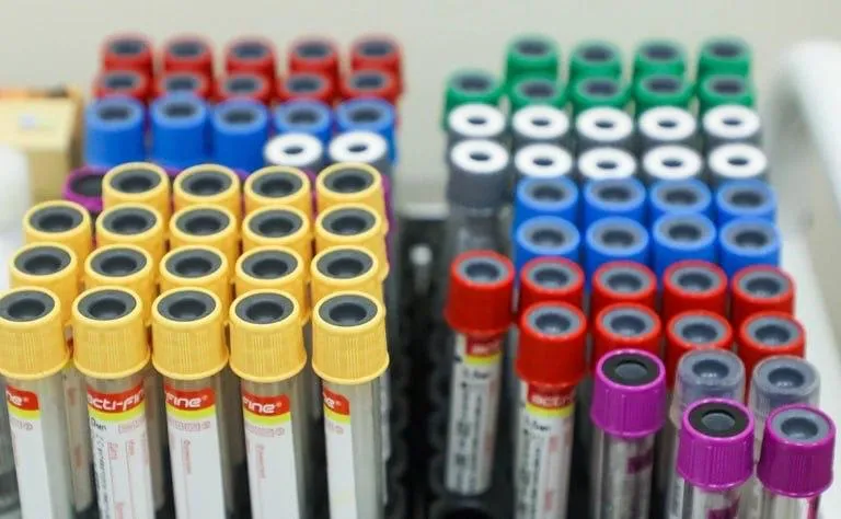 ВІЛ у росії поширюється втричі швидше, ніж у Європі