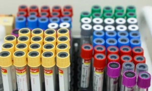 Франція хоче запровадити оплату медицини для пенсіонерів поза ЄС — Politico