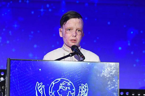 Постраждалий від удару рф по Вінниці хлопчик отримав міжнародну нагороду Cinema for Peace