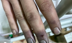 У черзі для проходу «зерновим коридором» у Туреччині стоять 77 суден