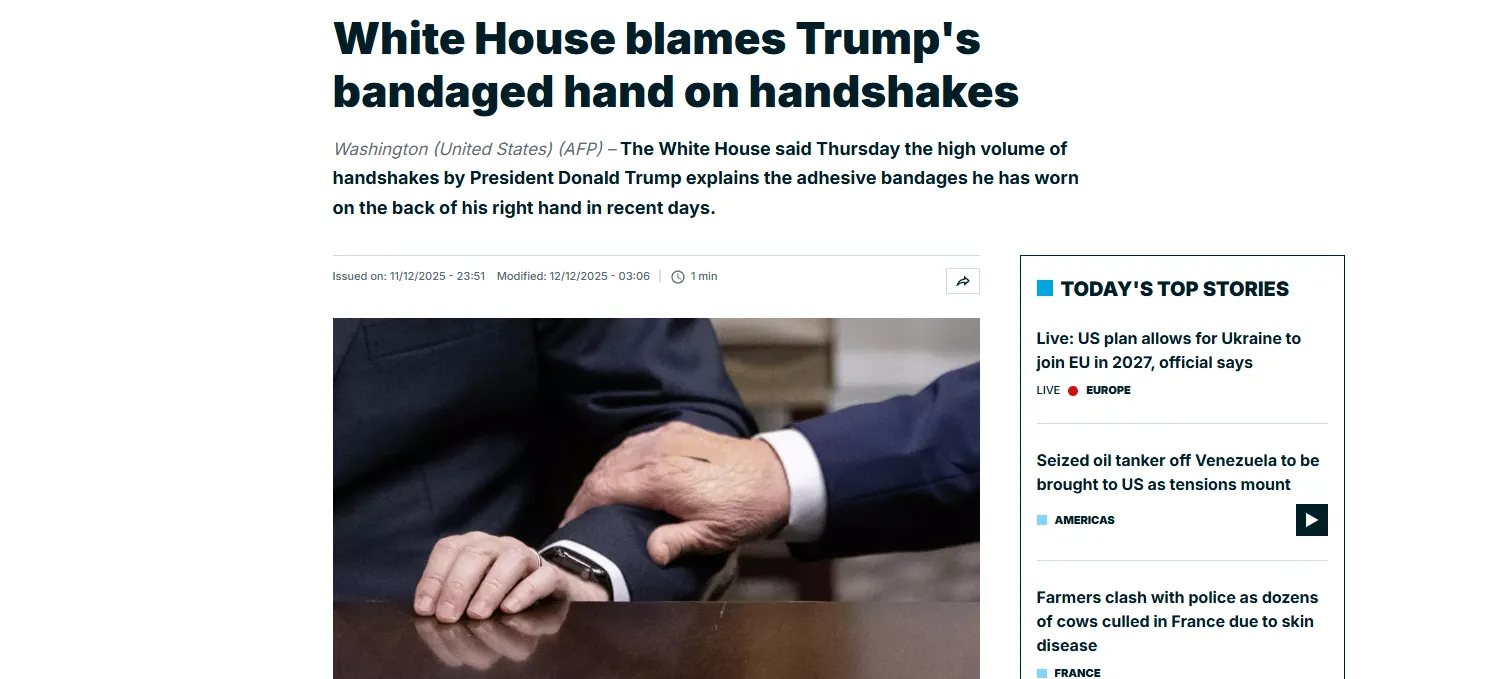 Білий дім пояснив, звідки у Трампа пластирі й синці на руках — France 24