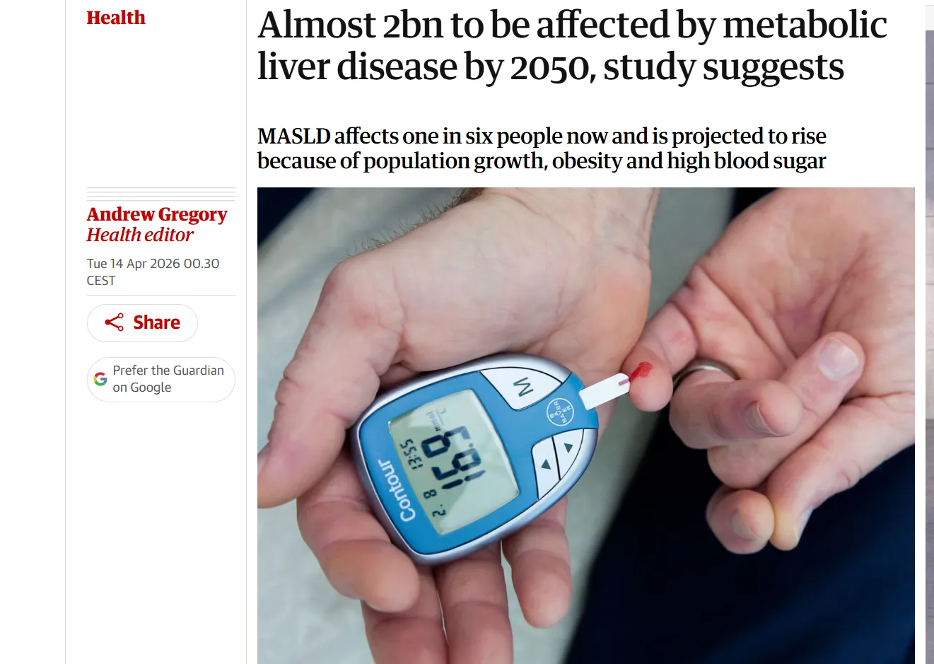 Світові загрожує масштабна епідемія метаболічної хвороби печінки — The Guardian