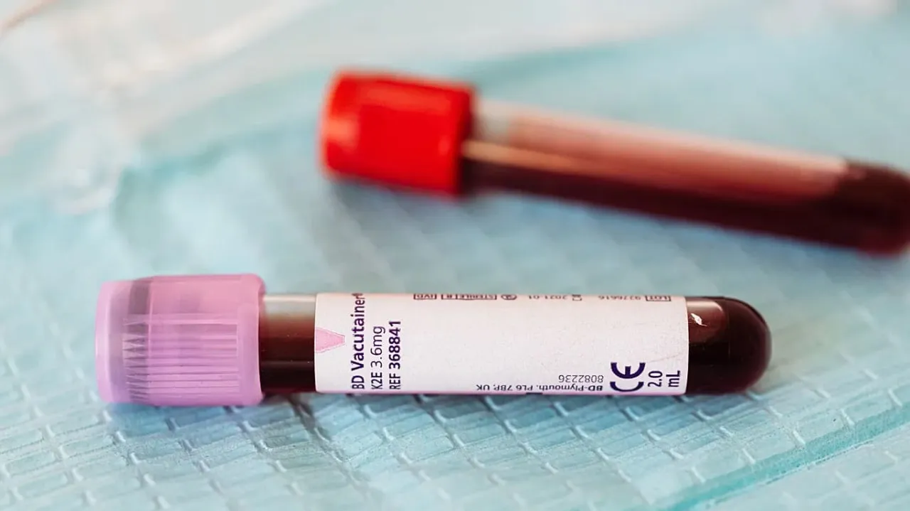 В Ефіопії підтвердили три смертельні випадки від вірусу Марбург