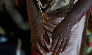 Косово приєдналося до декларації G7 щодо підтримки України