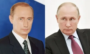 Вчені виявили новий метод поширення хвороби Альцгеймера між людьми