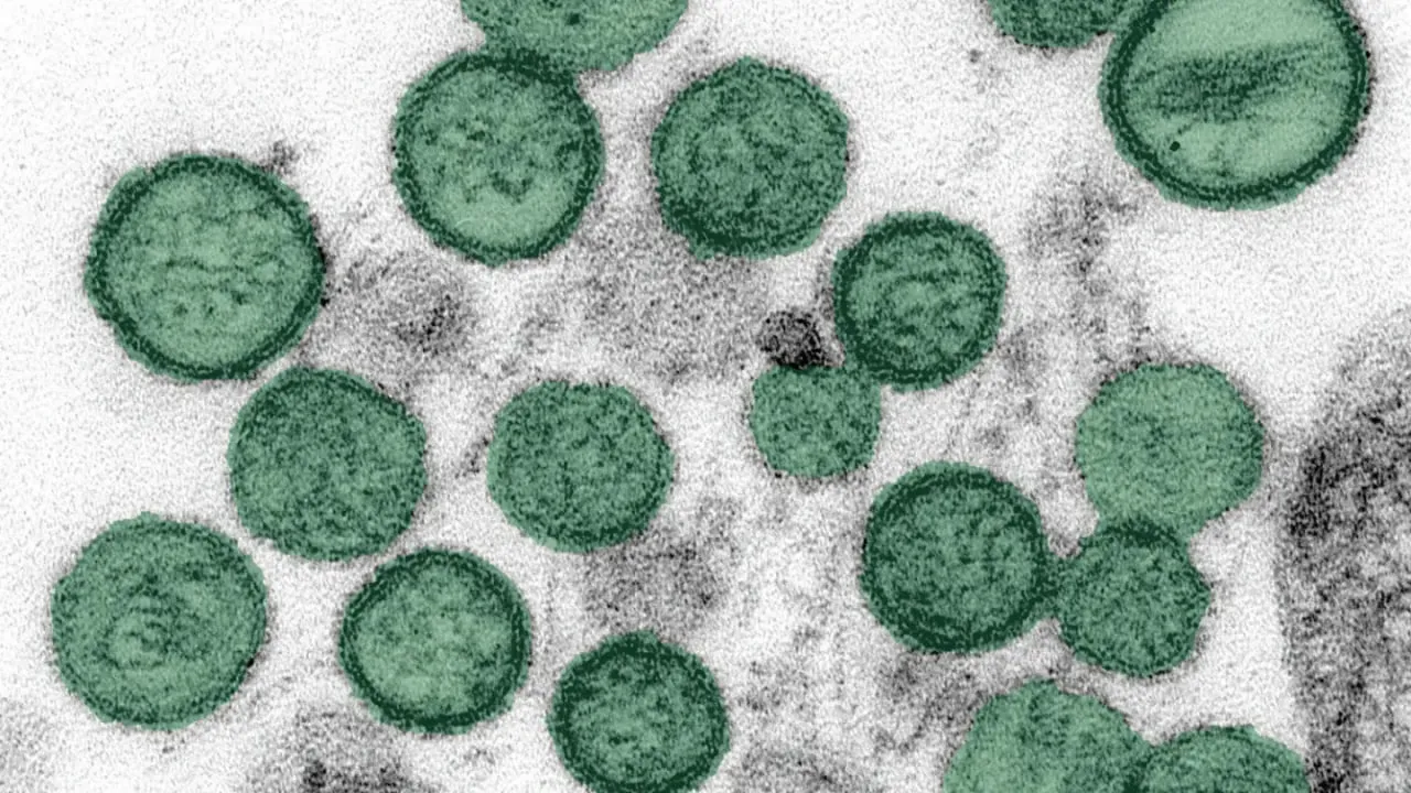 A man in the Lviv region tested positive for hantavirus after a trip to Croatia