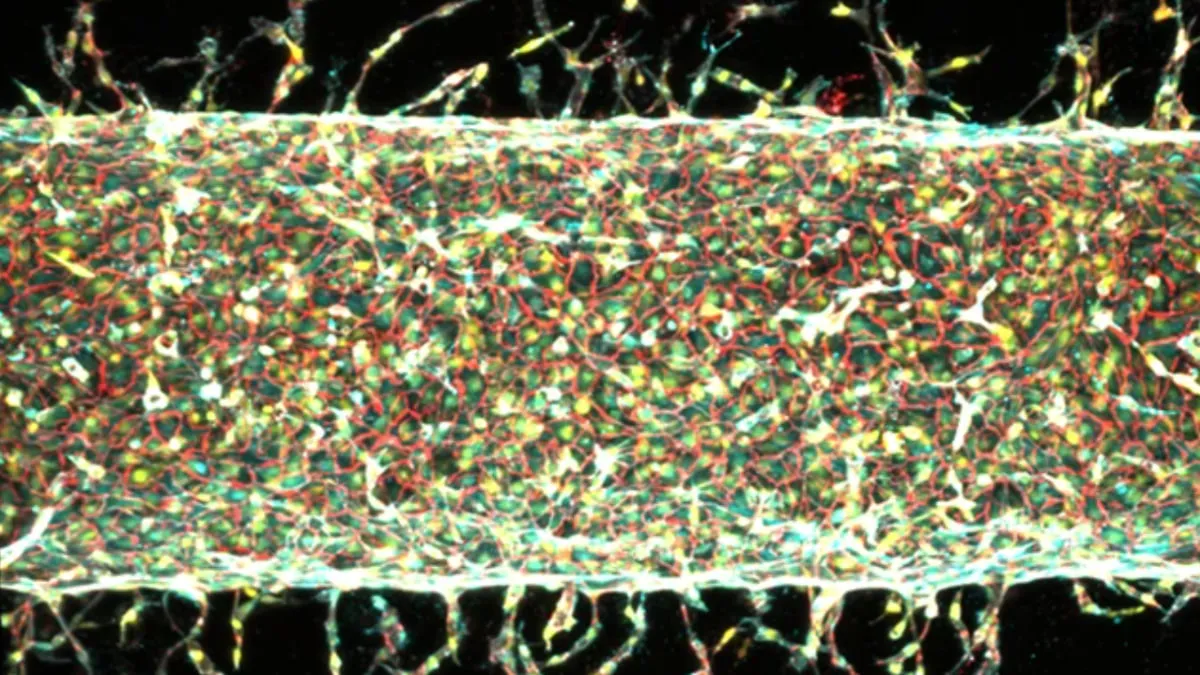 Scientists have learned to control the growth of blood vessels using magnets