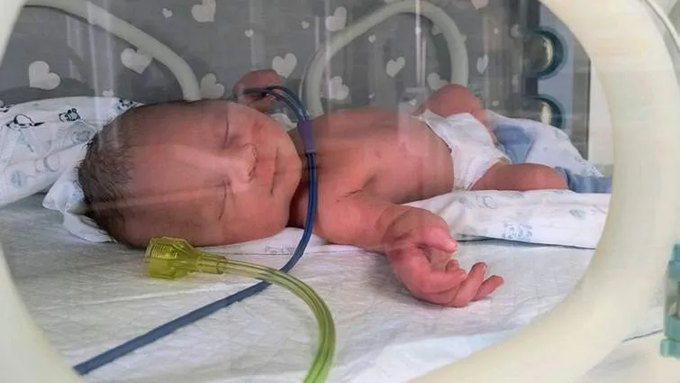 Doctors in Lviv set a record: after her water broke, the pregnancy was successfully maintained for another 97 days
