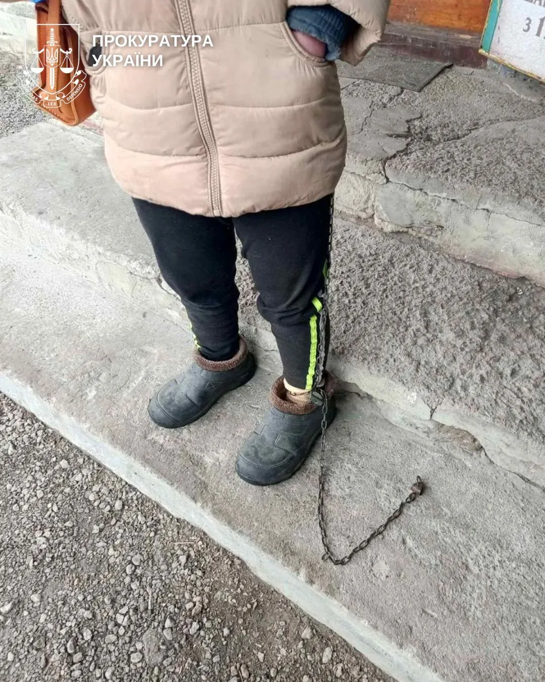 У дитбудинку на Кіровоградщині дівчину-інваліда тримали на ланцюгу – фото