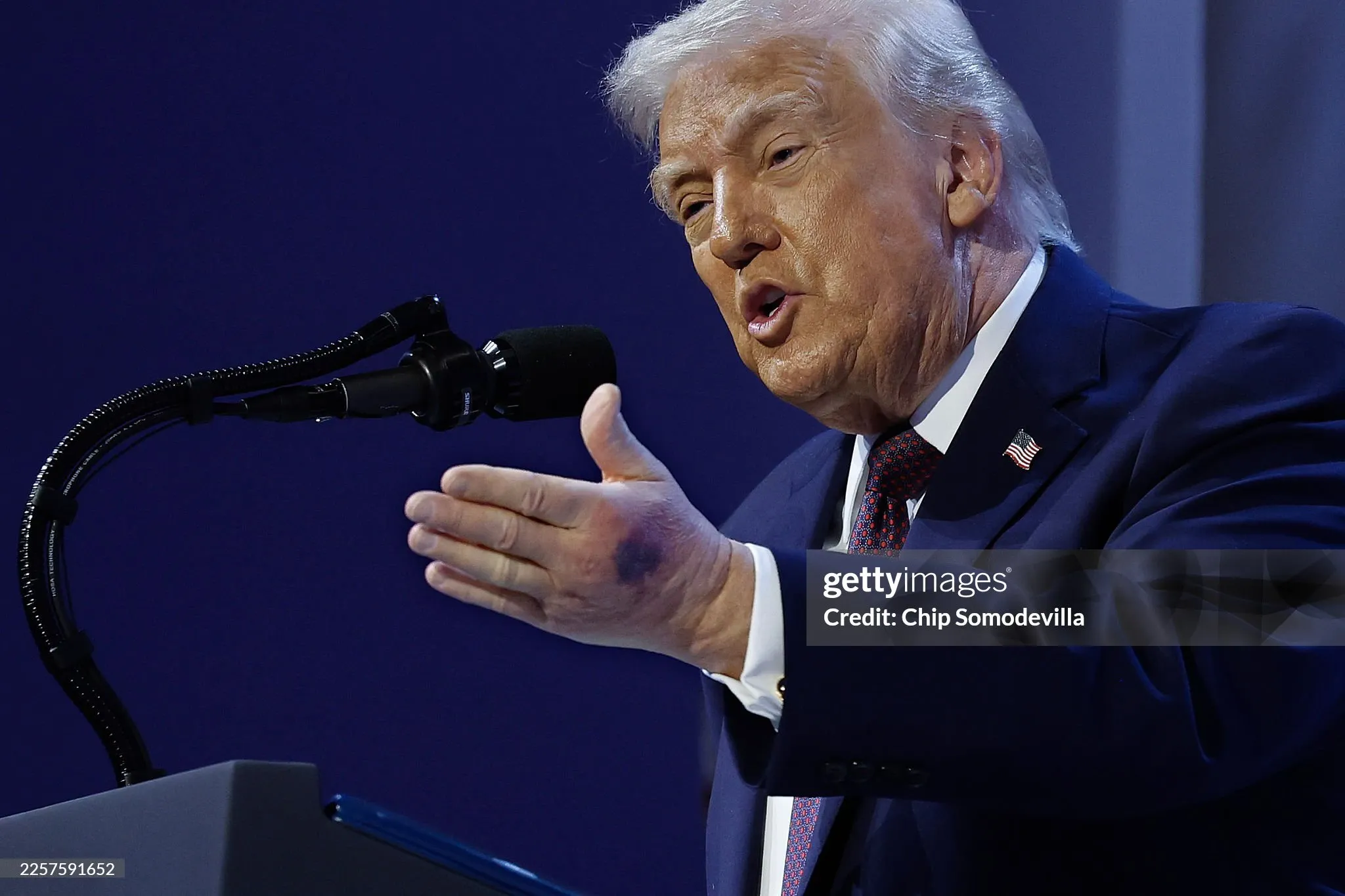 Нові фото Трампа з помітними синцями на івенті у Давосі