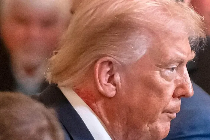 Трамп з’явився на публіці з помітною червоною плямою на шиї
