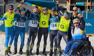 Як усунути пігментацію та купероз на обличчі: про Nordlys IPL-терапію розповідає косметолог LEO BEAUTY CLINIC