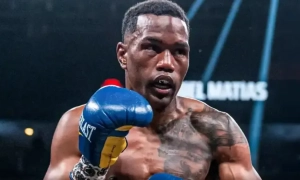 Тулієвий лазер LaseMD: про ефективне лікування випадіння волосся розповідає косметолог LEO BEAUTY CLINIC