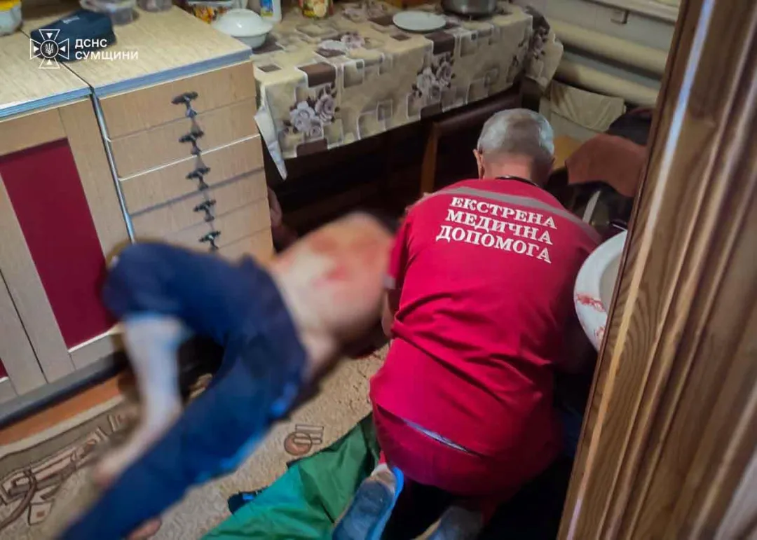 Россияне нанесли удар по жилому району в Сумах, есть пострадавший