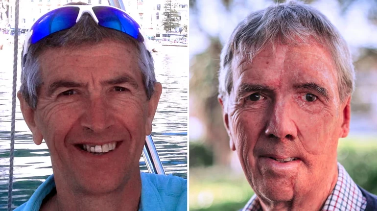 W Wielkiej Brytanii mężczyźnie, który stracił twarz w wyniku wypadku, wydrukowano nową przy użyciu drukarki 3D