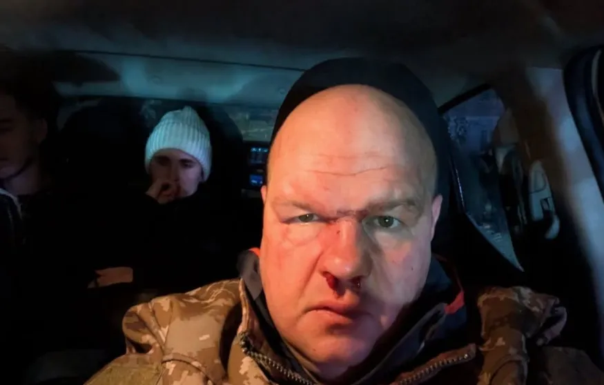 Відео: у Кременці п’яні молодики побили майора ЗСУ після ДТП