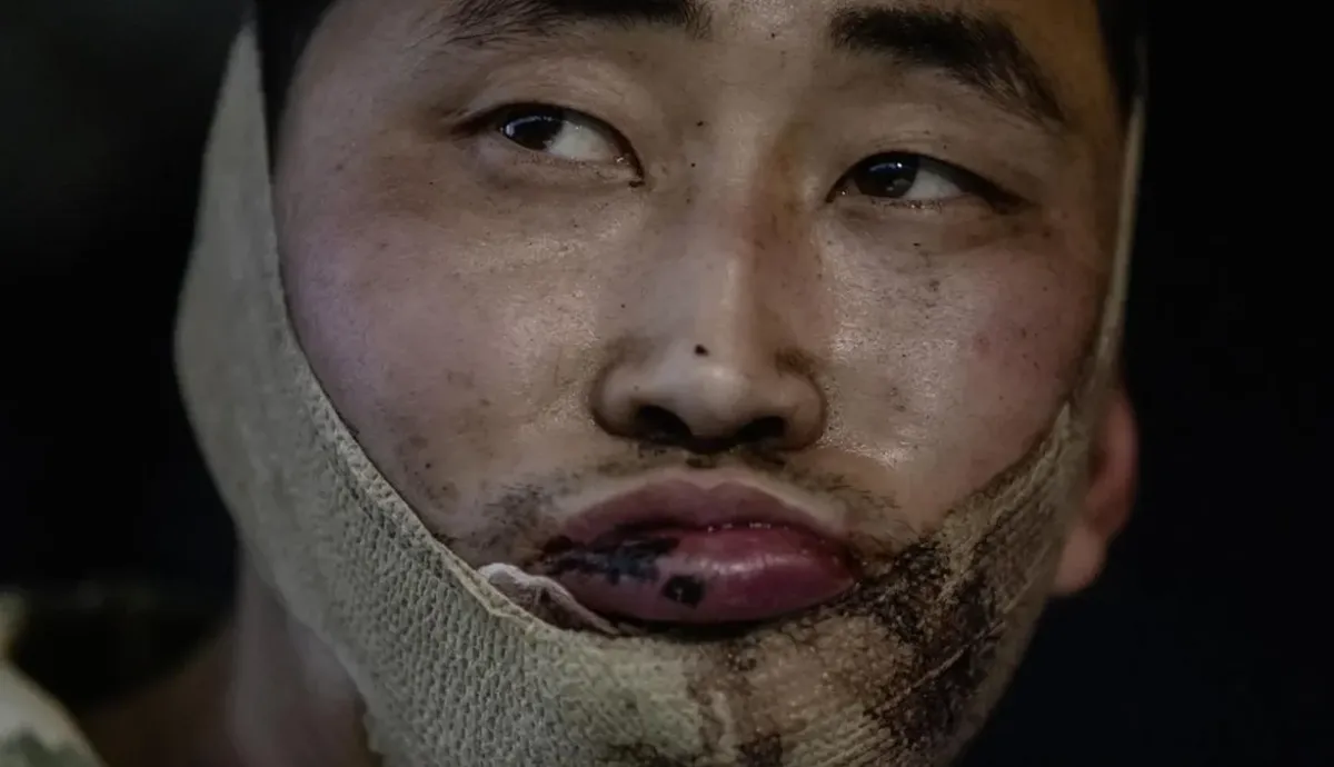 Україна не поверне полонених солдатів КНДР росії