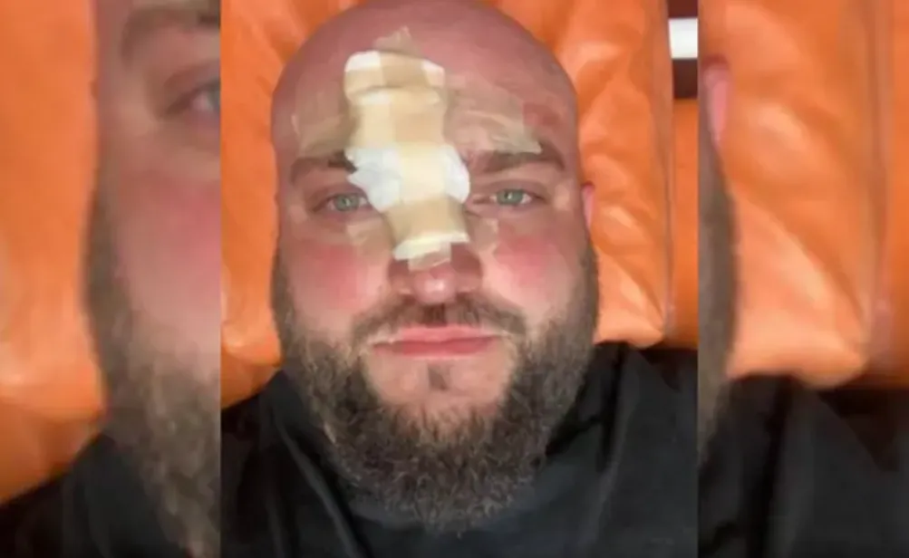 Видео: В Одесской области мужчина избил военного после замечания по поводу русской музыки