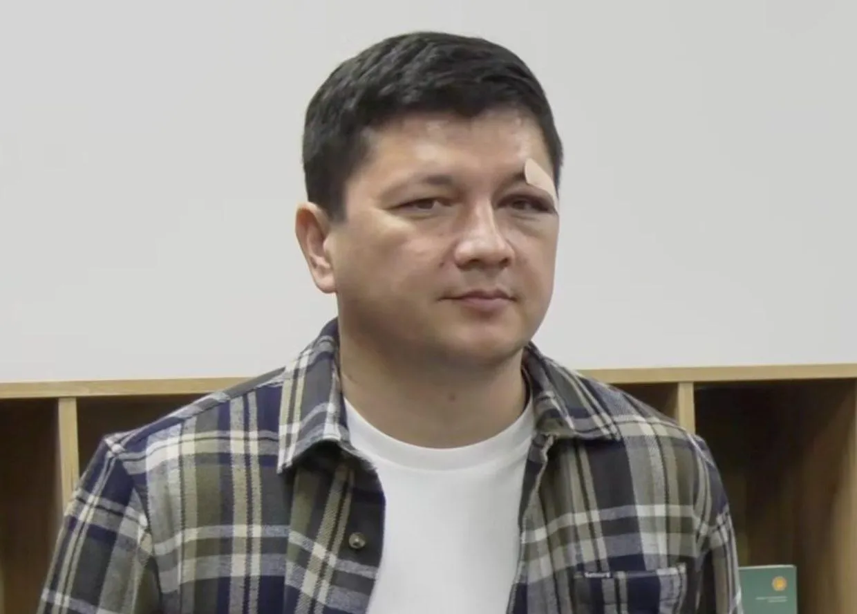 图：维塔利·金在公开场合露面时，眼睛周围有淤青和肿胀
