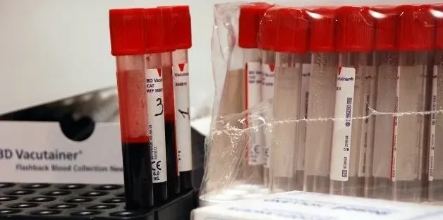 Росія планує перевірити на ВІЛ кожного третього громадянина