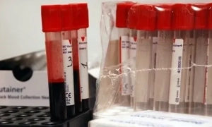 Gazprom reported new drone attacks by the Ukrainian Armed Forces on compressor stations