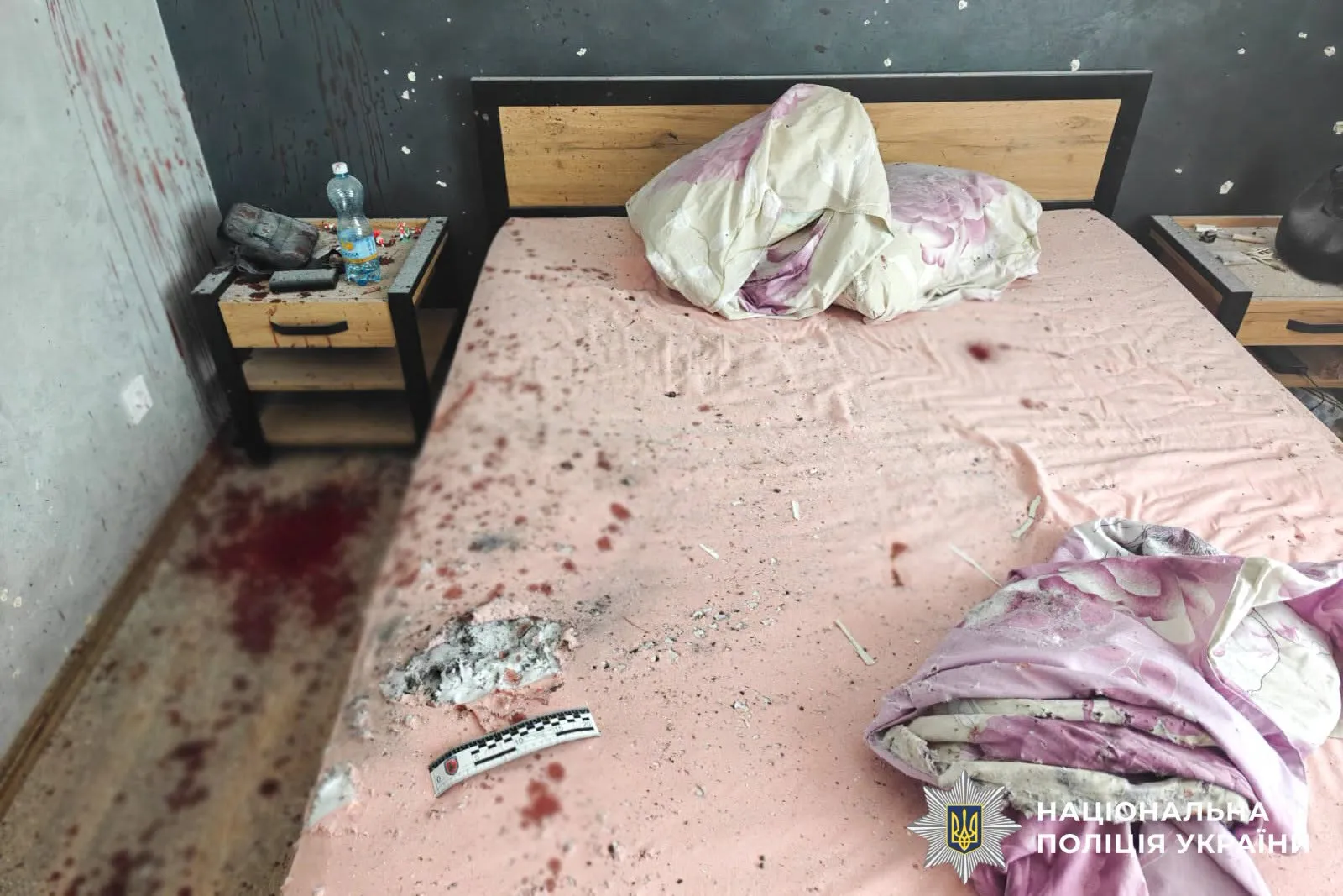 На Рівненщині чоловіку повідомили про підозру після вибуху гранати