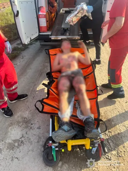 In Lviv, a 13-year-old train surfer suffered burns while taking a selfie on a train car