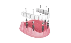 Три человека погибли от ракетного удара россиян по медцентру в Запорожье