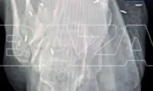 Росія атакувала АЗС у Харкові: є постраждалі