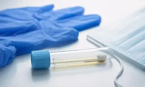 科学家发现过量RNA会直接损害线粒体——ScienceDaily