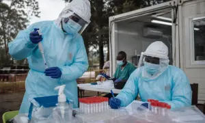 Меркель обговорила з Путіним Донбас, Карабах і Навального