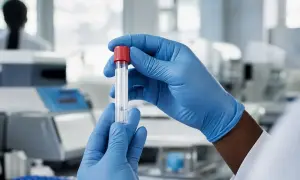 Experts urge Africa to mount a joint response to new Ebola cases — News-Medical