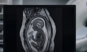 Study shows sarcoma was transmitted between twins before birth — ScienceAlert