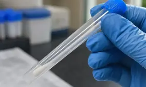 CDC у США змінив спосіб обліку смертей від кору