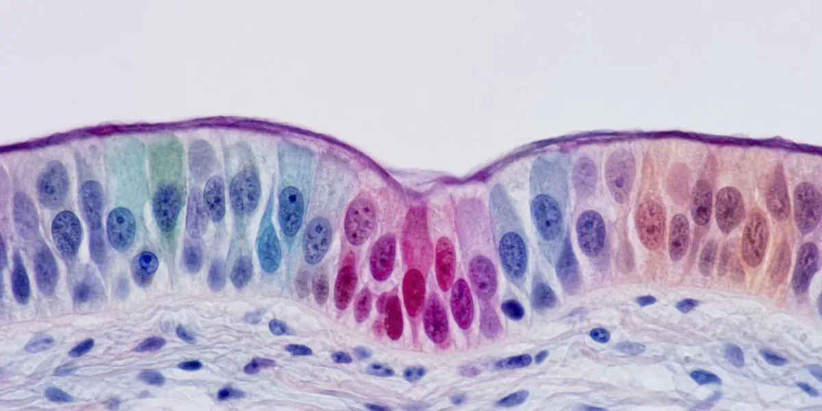 Scientists find cells that survive after apoptosis is triggered — ScienceDaily