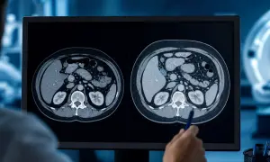 研究人员解释 APOE ε4 如何削弱血脑屏障——ScienceDaily