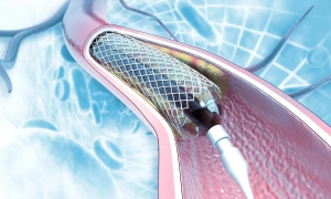  Нардеп всерйоз взявся за розслідування витрат на «відрядження» посадовців 