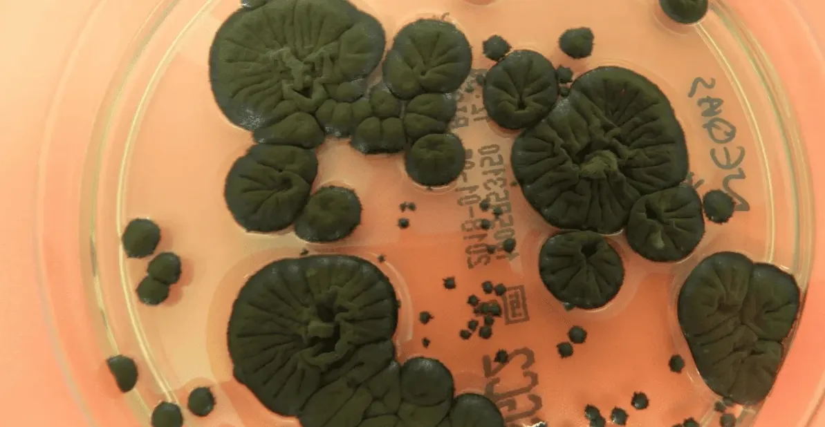 Чорнобильський грибок-пожирач може захистити астронавтів у космосі