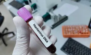 На Чернігівщині підліток поранений через вибух запалу, привезеного батьком з фронту