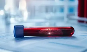 Naukowcy powiązali profil białkowy krwi z ryzykiem chorób związanych z wiekiem — Live Science