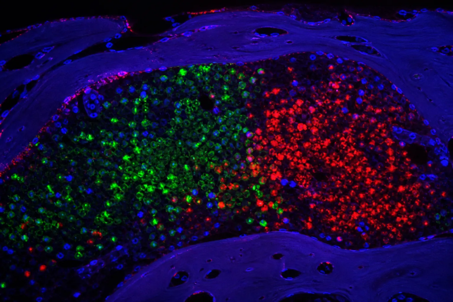 Immune structures discovered in mouse skull bone marrow