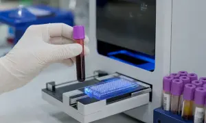 美国研究人员将加速衰老与早发癌症联系起来