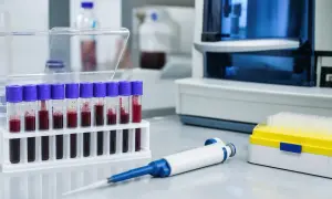 Eksperci w Ghanie wyjaśnili, dlaczego sama dieta nie wystarcza do kontroli otyłości