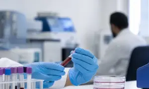 28% взрослых в США признались во лжи ради антибиотиков — Live Science