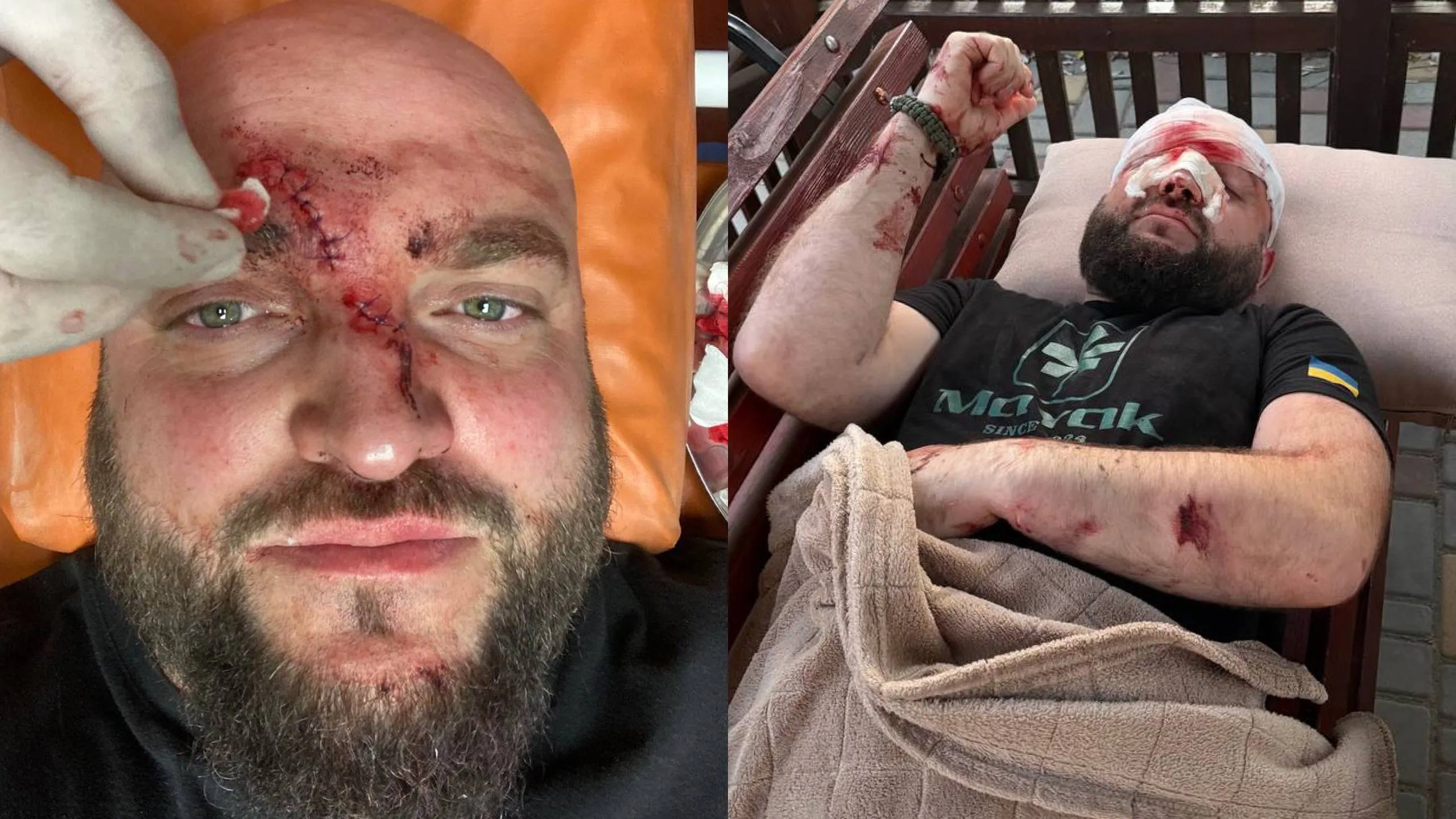 Полиция устанавливает лиц, причастных к избиению ветерана АТО в Затоке из-за русской музыки