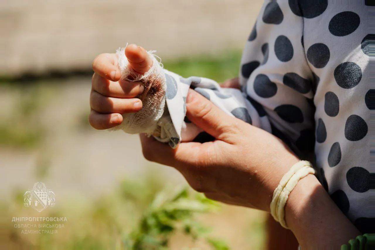 На Дніпропетровщині кількість загиблих через атаку рф зросла до 21, понад 300 людей постраждали