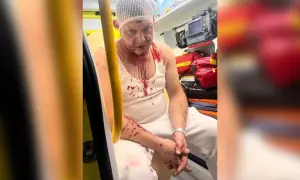 Фото: у Торонто з’явився пам’ятник жертвам Голодомору українців