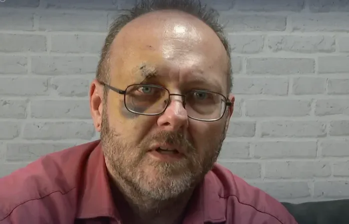 У Німеччині напали на експолітика «Альтернативи для Німеччини», держбезпека веде розслідування