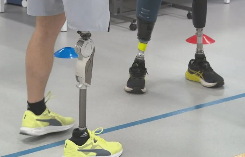 У Києві запустили безкоштовну програму протезування для постраждалих від війни